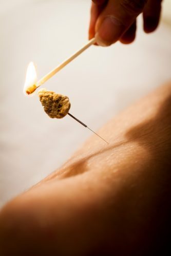 moxibustion-o46vo21m1i13q7iqjdfna5k8qkl0ytxwd0tpgy6ebk